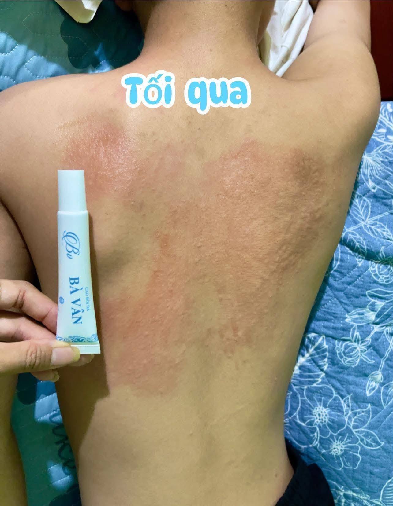Review Kem Đông Y Đa Năng Bà Vân có tốt không? Giá bao nhiêu