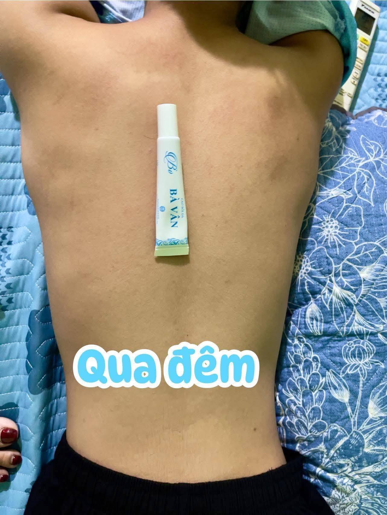 Review Kem Đông Y Đa Năng Bà Vân có tốt không? Giá bao nhiêu