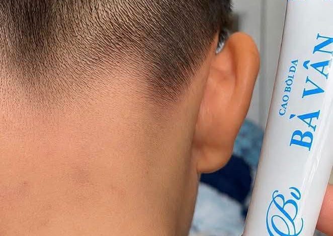 Review Kem Đông Y Đa Năng Bà Vân có tốt không? Giá bao nhiêu