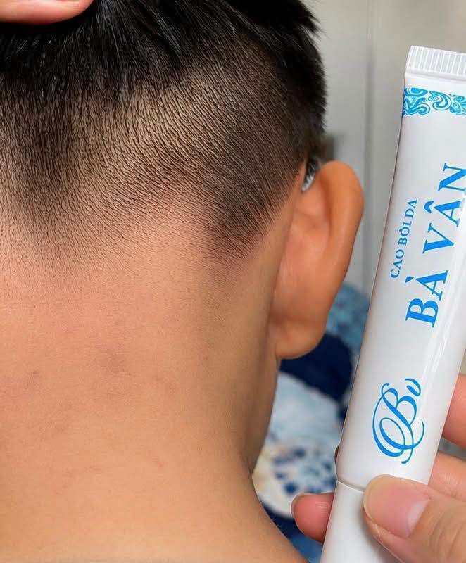 Review Kem Đa Năng Bà Vân có tốt không? Giá bao nhiêu