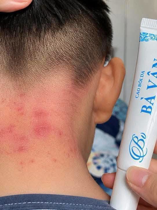 Review Kem Bà Vân có tốt không? Giá bao nhiêu