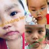 Kem Đa Năng Bà Vân trị chốc lở