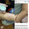 Kem Đa Năng Bà Vân trị muỗi đốt