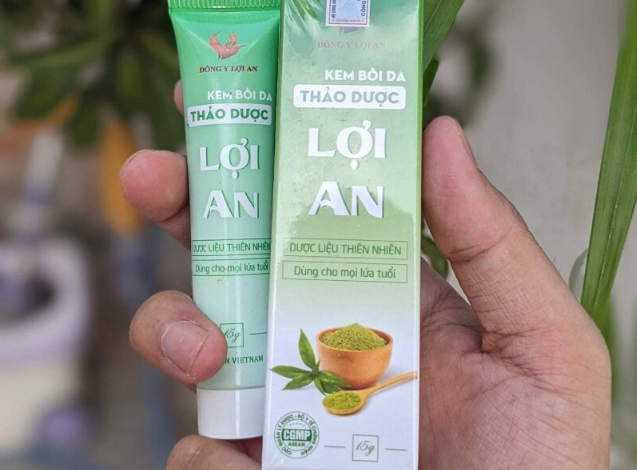 Review kem bôi da Lợi An: Có tốt không? Có nên dùng cho trẻ nhỏ không?